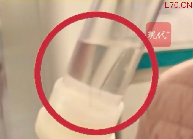 三岁患儿输液管内发现头发 医患双方各执一词待鉴定