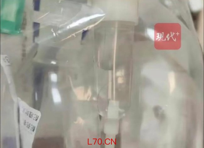 三岁患儿输液管内发现头发